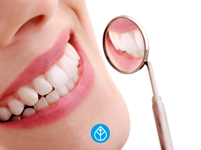 Come salvaguardare un bel sorriso